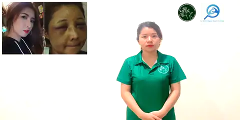 biến dạng - Ngôn Ngữ ký Hiệu - Vùng miền Thành Phố Hồ Chí Minh - Phân loại Sức khỏe - Bộ phận cơ thể, Động Từ, Dự Án 250 Ký Hiệu Y Khoa