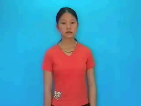 bỏng (phỏng) - Ngôn Ngữ ký Hiệu - Vùng miền Lâm Đồng - Phân loại Sức khỏe - Bộ phận cơ thể