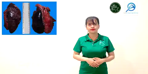 cấp tính (1) - Ngôn Ngữ ký Hiệu - Vùng miền Thành Phố Hồ Chí Minh - Phân loại Sức khỏe - Bộ phận cơ thể, Tính Từ, Dự Án 250 Ký Hiệu Y Khoa