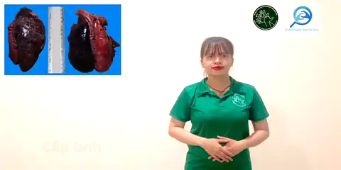 cấp tính (2) - Ngôn Ngữ ký Hiệu - Vùng miền Thành Phố Hồ Chí Minh - Phân loại Sức khỏe - Bộ phận cơ thể, Tính Từ, Dự Án 250 Ký Hiệu Y Khoa