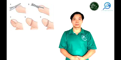 cắt bao quy đầu - Ngôn Ngữ ký Hiệu - Vùng miền Thành Phố Hồ Chí Minh - Phân loại Sức khỏe - Bộ phận cơ thể, Động Từ, Dự Án 250 Ký Hiệu Y Khoa