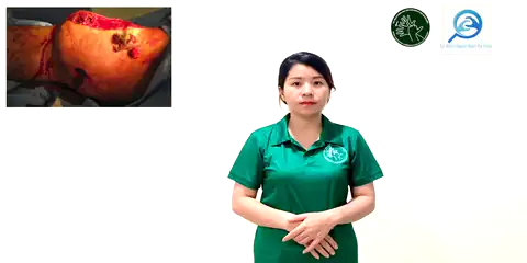 đau xuyên thấu - Ngôn Ngữ ký Hiệu - Vùng miền Thành Phố Hồ Chí Minh - Phân loại Sức khỏe - Bộ phận cơ thể, Tính Từ, Dự Án 250 Ký Hiệu Y Khoa