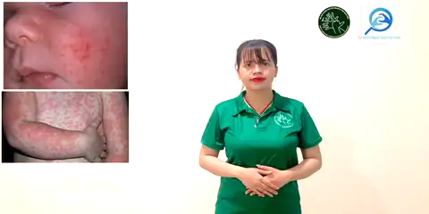 dị ứng - Ngôn Ngữ ký Hiệu - Vùng miền Thành Phố Hồ Chí Minh - Phân loại Sức khỏe - Bộ phận cơ thể, Dự Án 250 Ký Hiệu Y Khoa