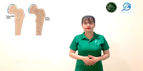 loãng xương - Ngôn Ngữ ký Hiệu - Vùng miền Thành Phố Hồ Chí Minh - Phân loại Sức khỏe - Bộ phận cơ thể, Danh Từ, Dự Án 250 Ký Hiệu Y Khoa