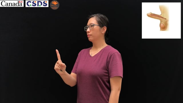 Dương vật cương cứng 1