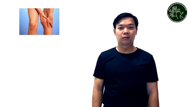 Mỏi chân