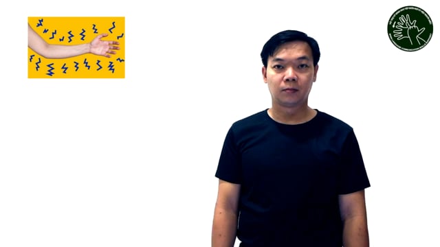 Mỏi tay