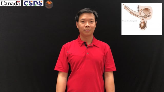 Xuất tinh ngoài