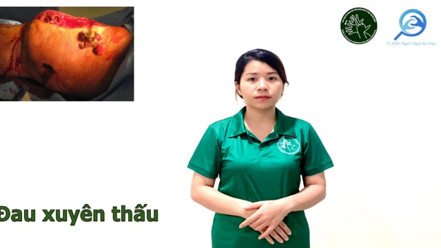 đau xuyên thấu