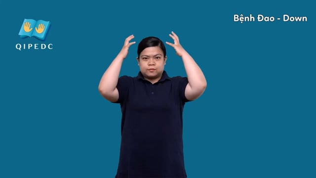 bệnh Đao - Down