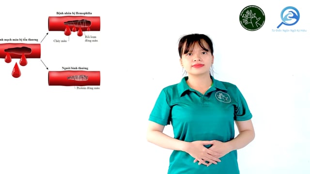 bệnh máu khó đông