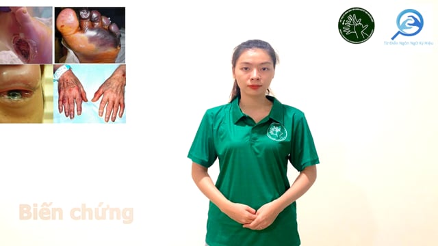 biến chứng