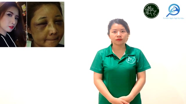 biến dạng