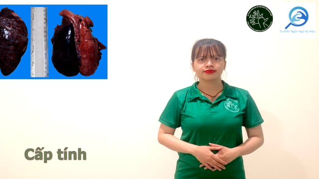 cấp tính (2)