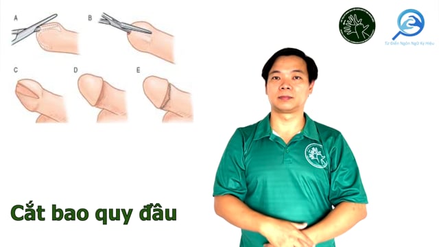 cắt bao quy đầu