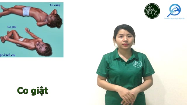 co giật