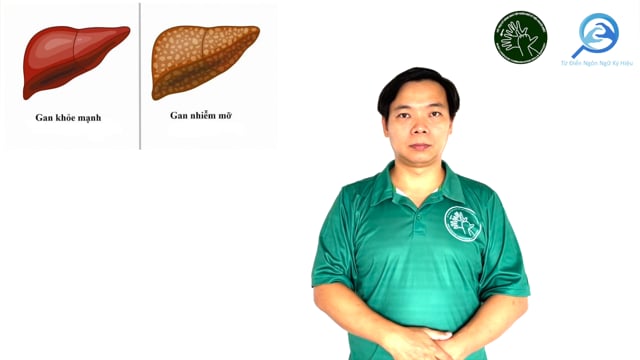 gan nhiễm mỡ
