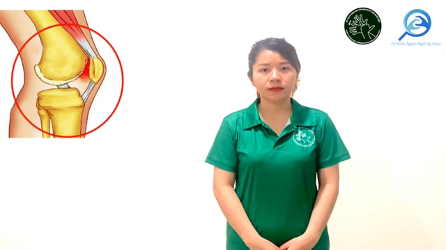 khớp
