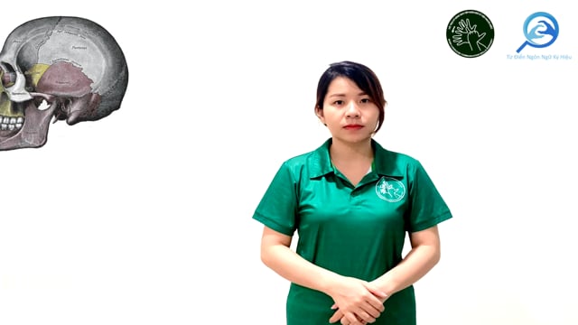 khớp bất động