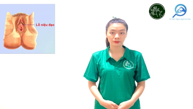 lỗ niệu đạo trong (nữ)