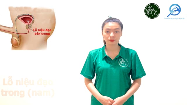 lỗ niệu đạo trong (nam)