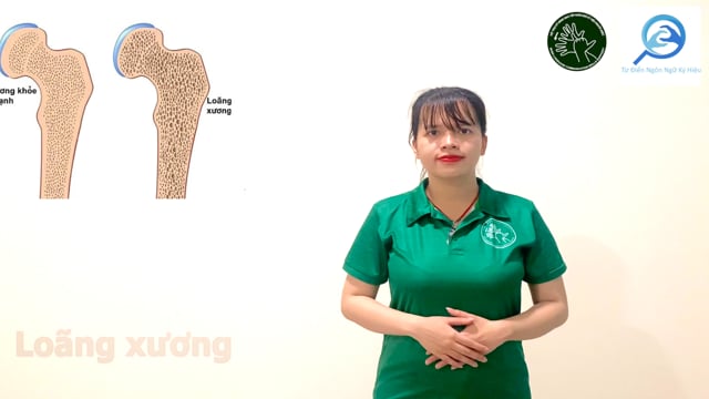 loãng xương