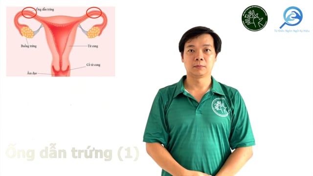ống dẫn trứng (1)