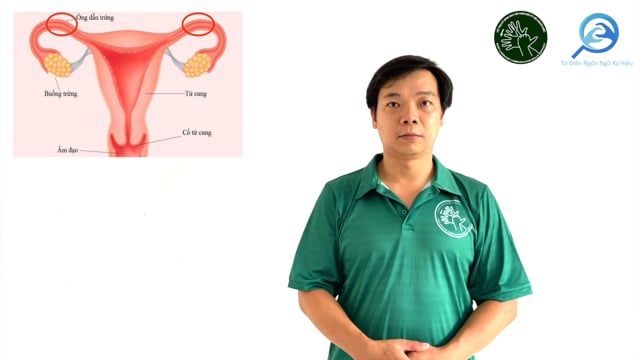 ống dẫn trứng (2)