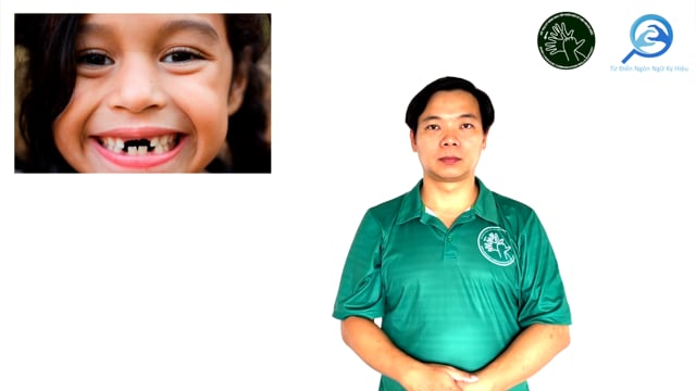 rụng răng