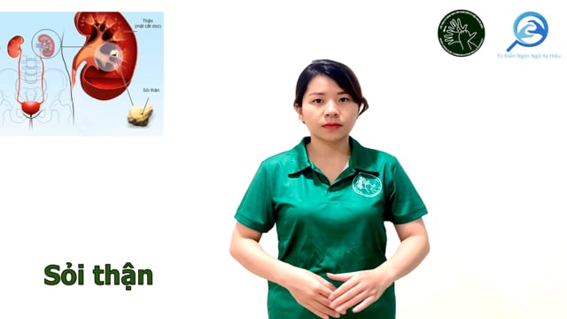 sỏi thận