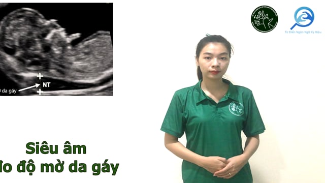 siêu âm độ mờ gáy