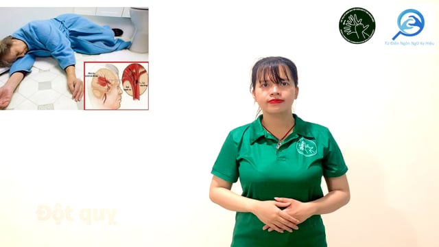 đột quỵ
