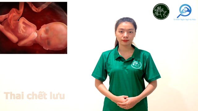 thai chết lưu