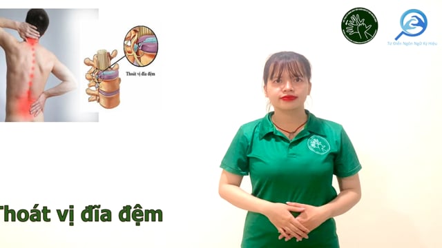 thoái vị đĩa đệm