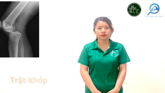trật khớp