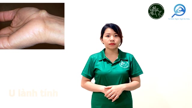 u lành tính