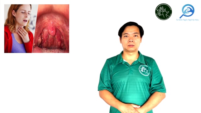 viêm họng