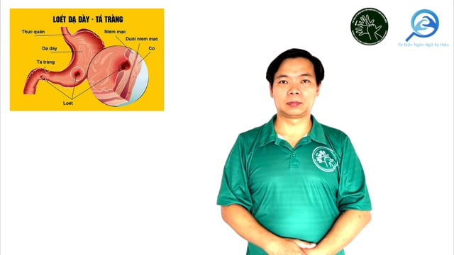 viêm loét dạ dày