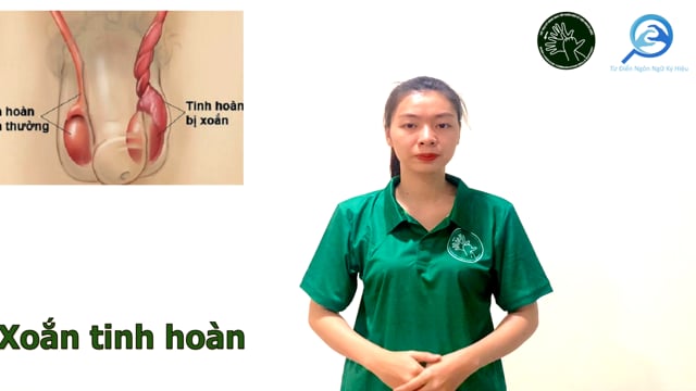 xoắn tinh hoàn