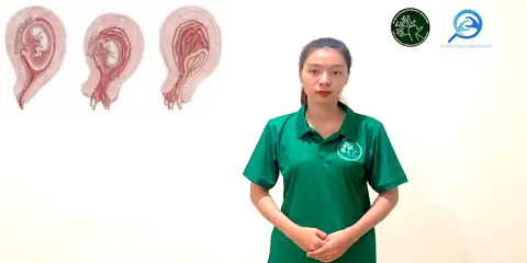 sẩy thai - Ngôn Ngữ ký Hiệu - Vùng miền Thành Phố Hồ Chí Minh - Phân loại Sức khỏe - Bộ phận cơ thể, Động Từ, Dự Án 250 Ký Hiệu Y Khoa