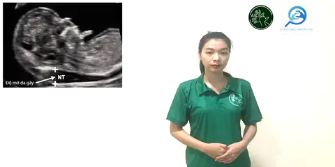 siêu âm độ mờ gáy - Ngôn Ngữ ký Hiệu - Vùng miền Thành Phố Hồ Chí Minh - Phân loại Sức khỏe - Bộ phận cơ thể, Danh Từ, Dự Án 250 Ký Hiệu Y Khoa