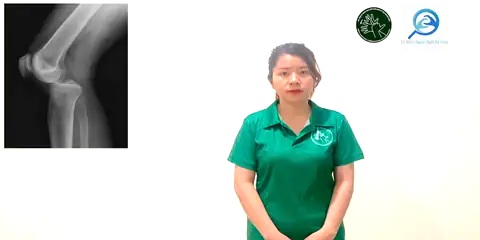 trật khớp - Ngôn Ngữ ký Hiệu - Vùng miền Thành Phố Hồ Chí Minh - Phân loại Sức khỏe - Bộ phận cơ thể, Động Từ, Dự Án 250 Ký Hiệu Y Khoa